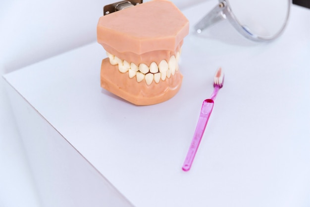 Modelo de prótesis dental removible completa