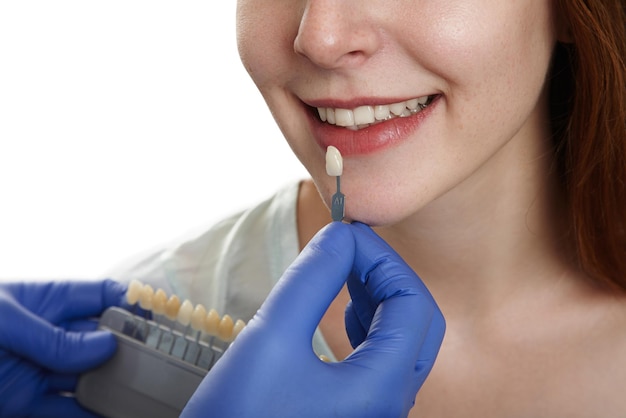 Selección del color de una corona dental con guía de tonos